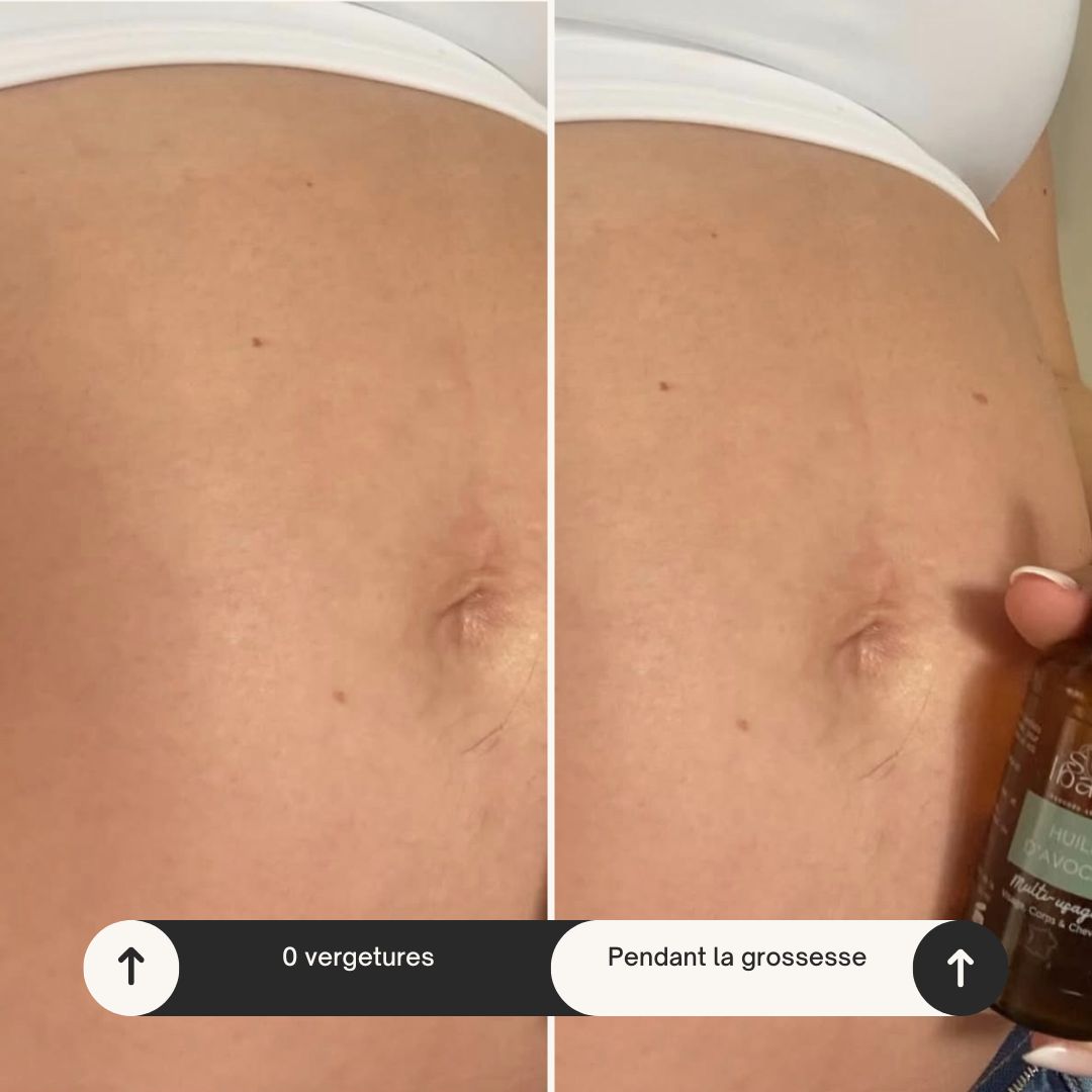 L'huile d'avocat - Tout en 1 – Image 4